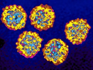 Hepatitis C virus seen through electron microscope. James Cavallini/Science Source