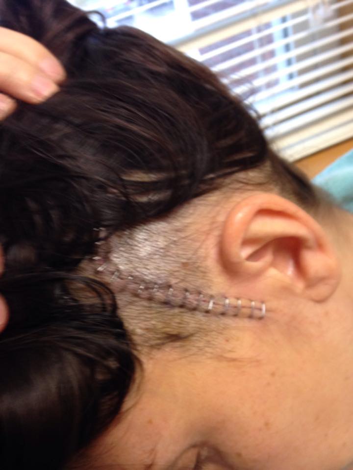 Michelle shows staples