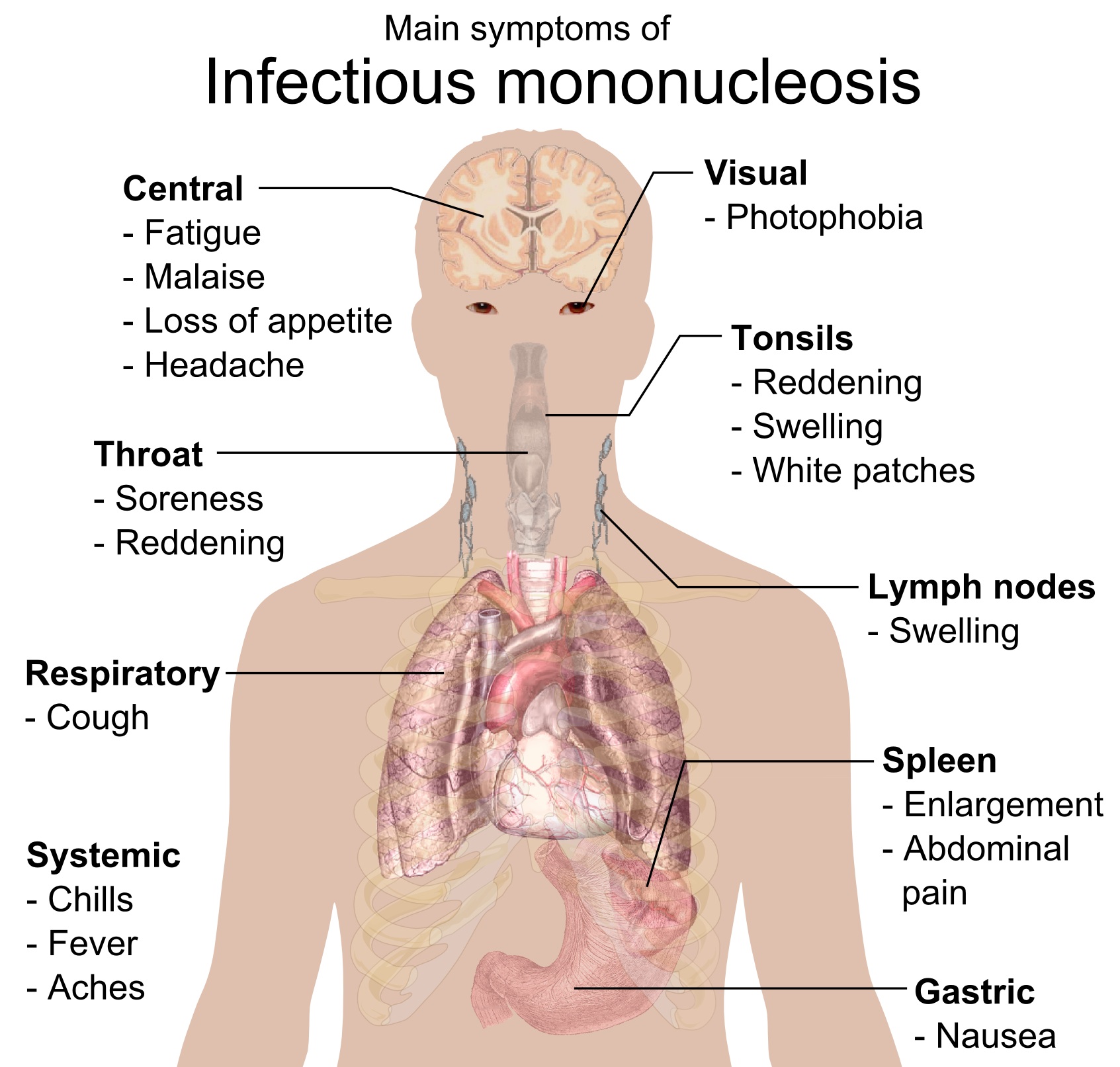 how-does-tonsillitis-feel-like-is-tonsillitis-contagious