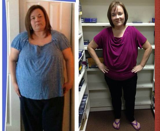 How Becky Sawtelle is Doing Eight Months After Weight Loss Surgery ...