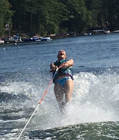 Luanne Cameron on water skis/hyperparathyroid