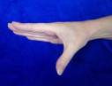 Palmar abduction thumb exercise