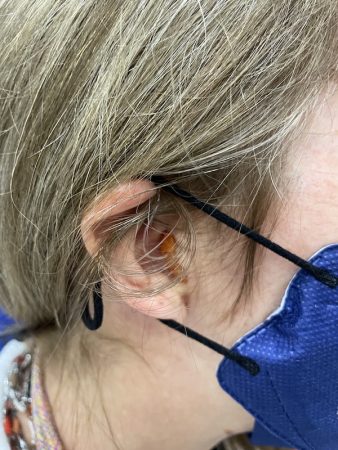 Debra/hearing loss/ wearing hearing aid
